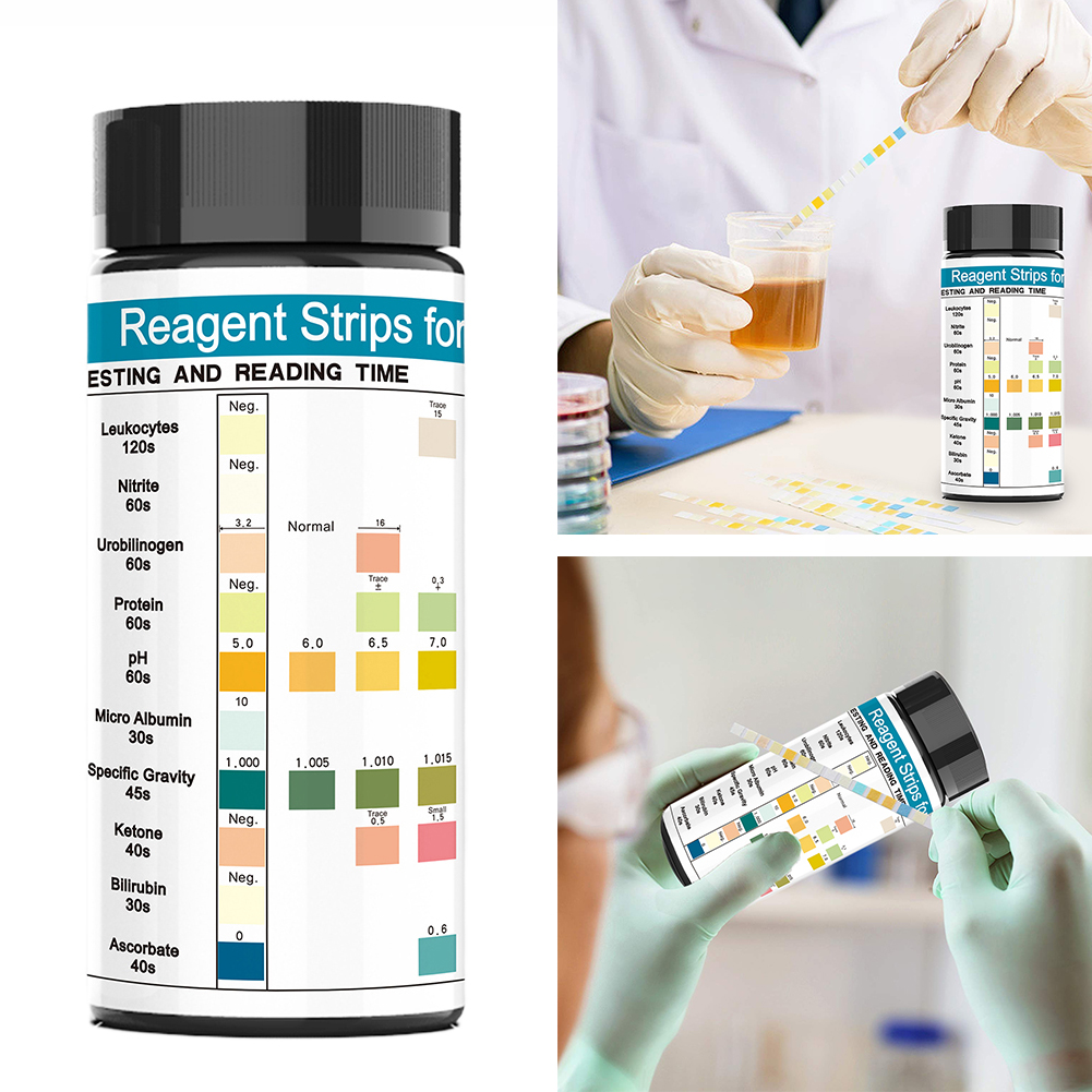100 Strips Urine Test Strip 10 – Urinalysis Reagent Strip Bewertung und Preis