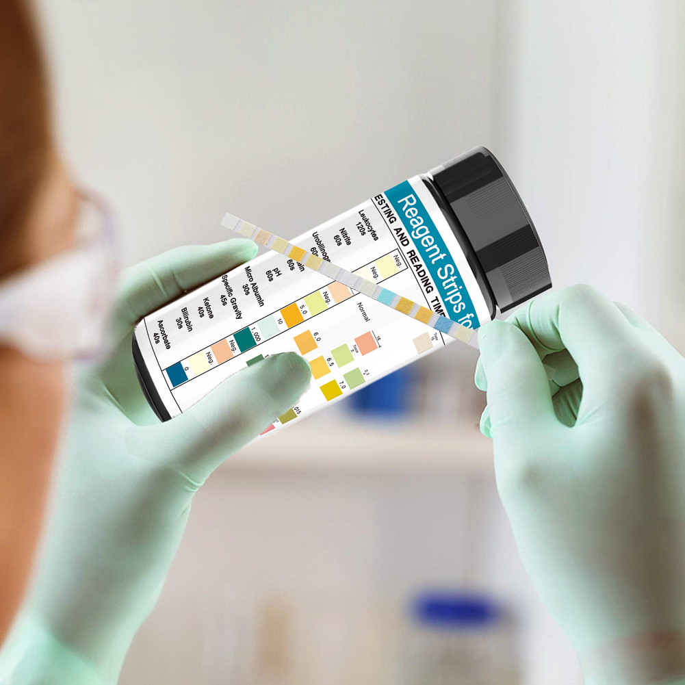 100 Strips Urine Test Strip 10 – Urinalysis Reagent Strip Bewertung und Preis
