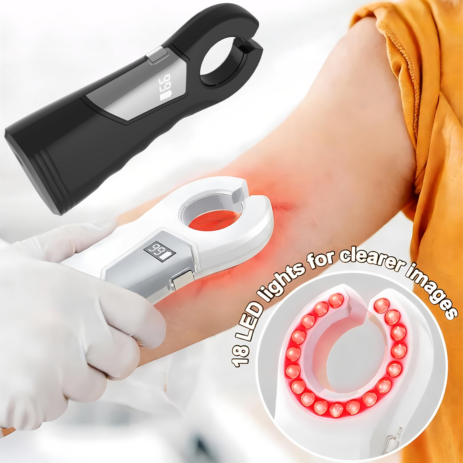 Medical Infrared Vein Locator  – Medical Lab Equipments Bewertung und Preis